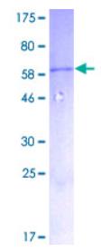 SDS-PAGE (MYD88-5796H).jpg